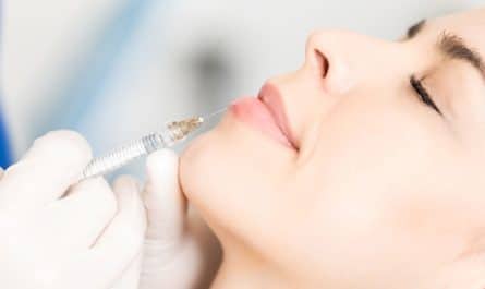 Augmentation des lèvres