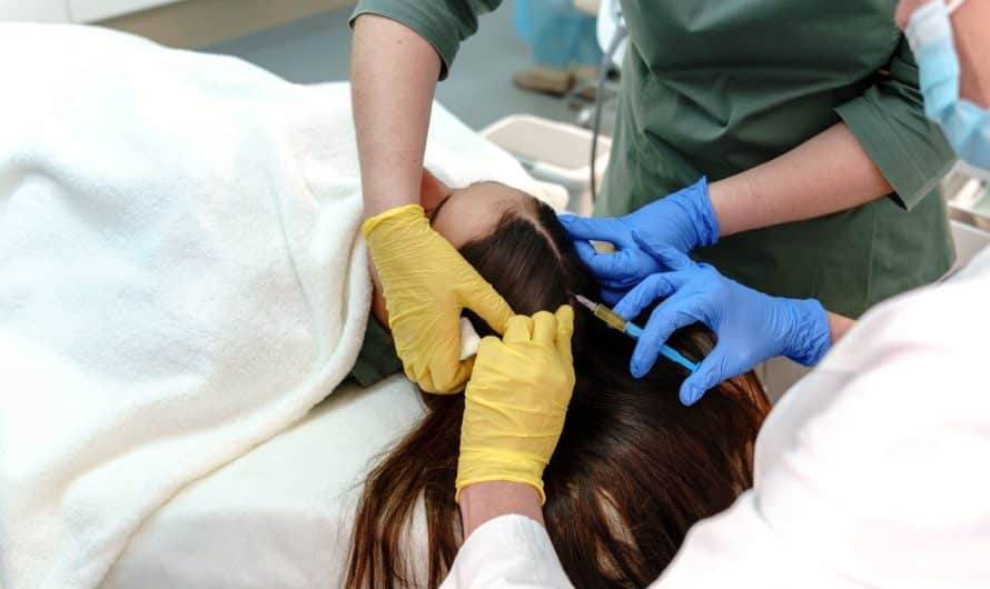 Greffe de cheveux : tout savoir sur la technique FUE