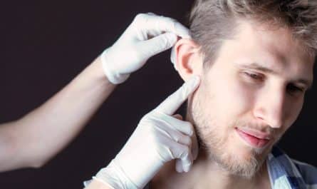 La chirurgie des oreilles décollées