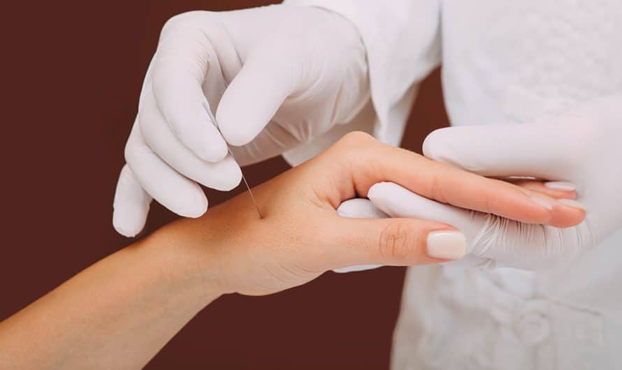 Rajeunissement des mains : les solutions de chirurgie esthétique